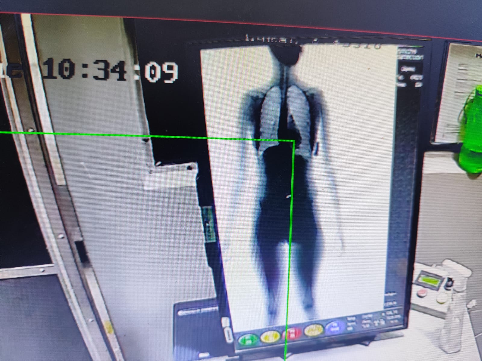 Capa: Mulher de detento tenta entrar em presídio de Eunápolis com drogas, mas é flagrada por BodyScan