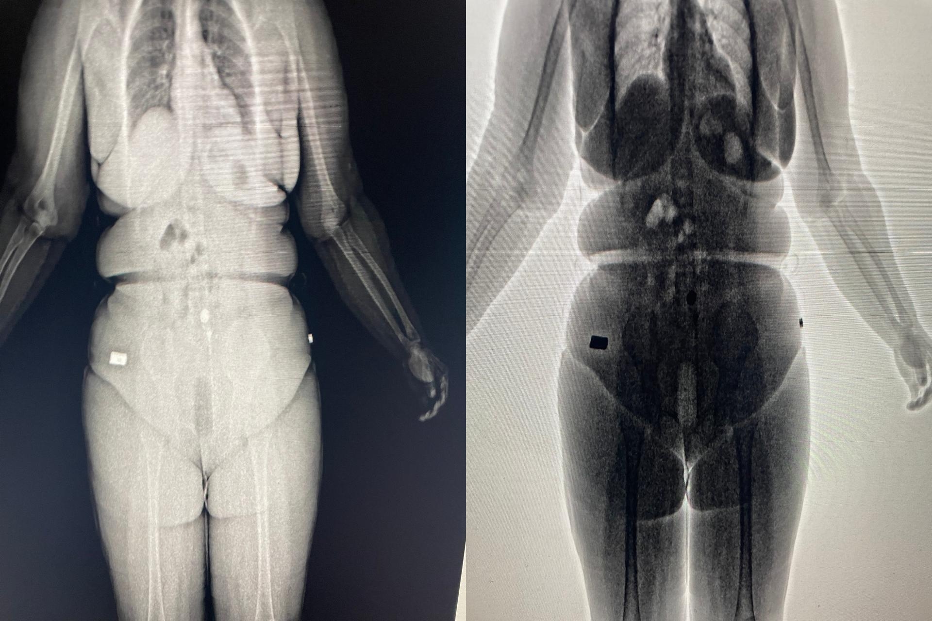 Capa: Mulheres são flagradas em scanner ao tentar entrar com drogas no Conjunto Penal de Barreiras