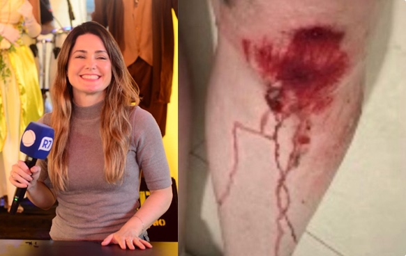 Capa: Apresentadora da Record é assaltada na porta de casa, em Salvador e fica ferida