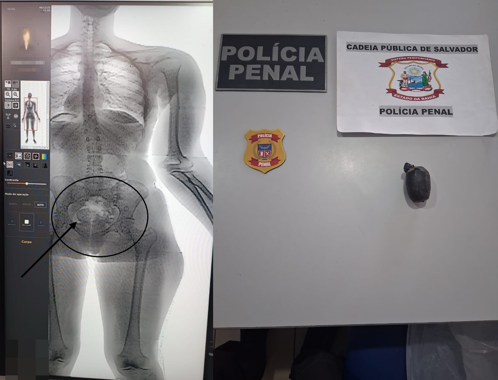 Capa: BodyScan: mulher é presa ao tentar entrar em presídio de Salvador com drogas nas partes íntimas