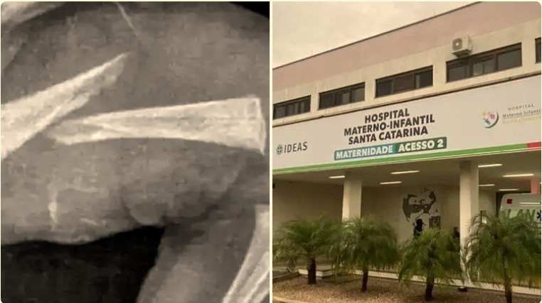 Capa: TJ-SC utiliza “perspectiva de gênero” e absolve mãe de 16 anos acusada de quebrar braço e perna do filho bebê